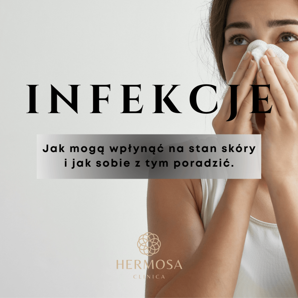 Jak infekcje mogą wpłynąć na stan skóry i jak ją regenerować? Jak infekcje mogą wpłynąć na stan skóry i jak ją regenerować?