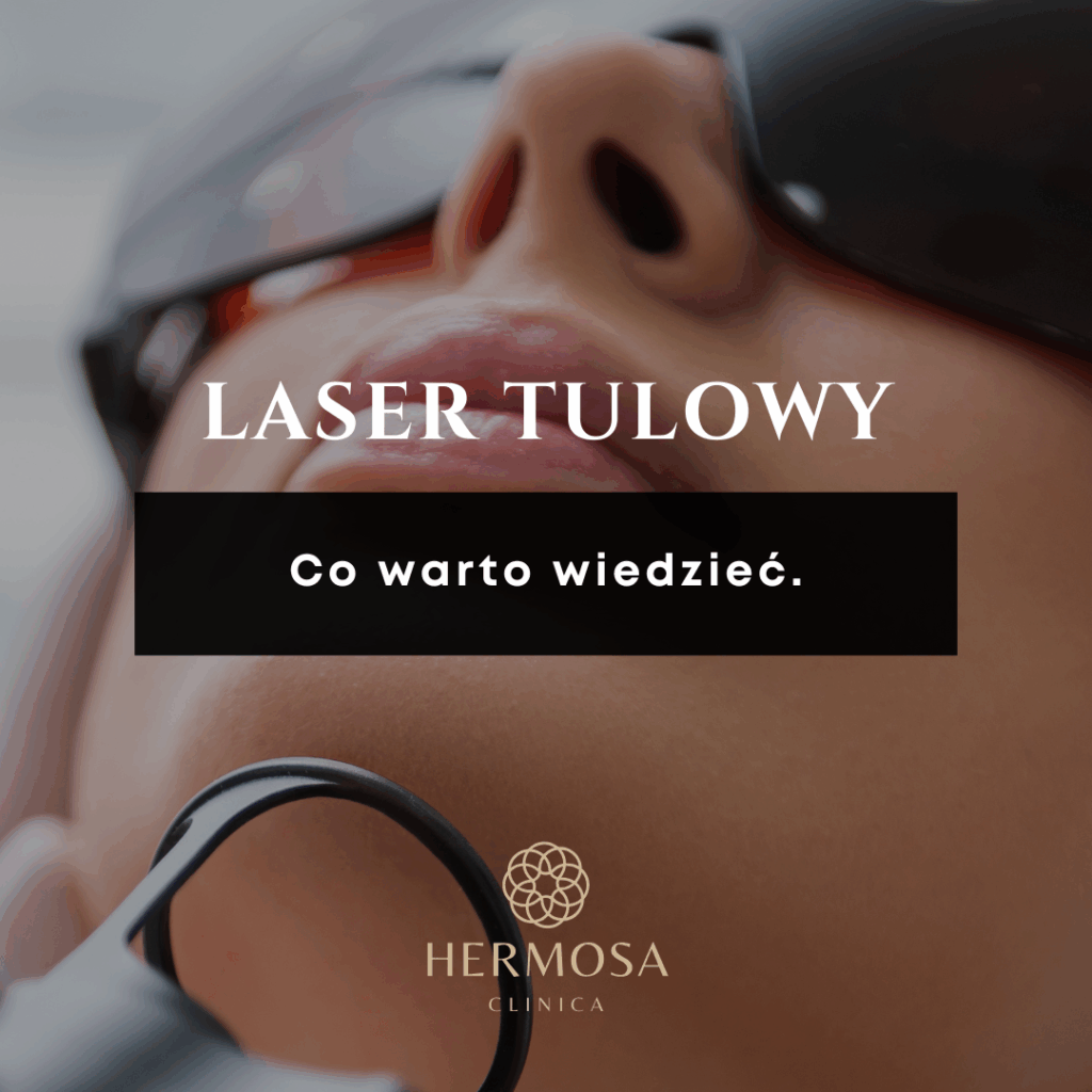 LASER TULOWY- co warto wiedzieć