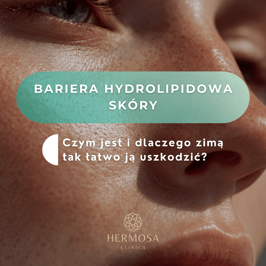 Strona główna BARIERA HYDROLIPIDOWA SKÓRY- czym jest i dlaczego zimą tak łatwo ją uszkodzić?