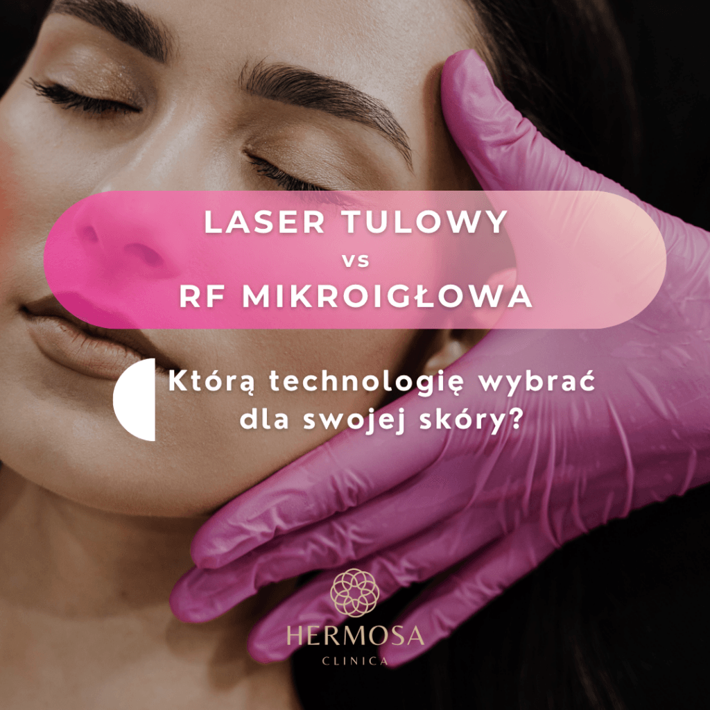Laser tulowy vs RF mikroigłowa – którą technologię wybrać dla swojej skóry? Laser tulowy vs RF mikroigłowa – którą technologię wybrać dla swojej skóry?